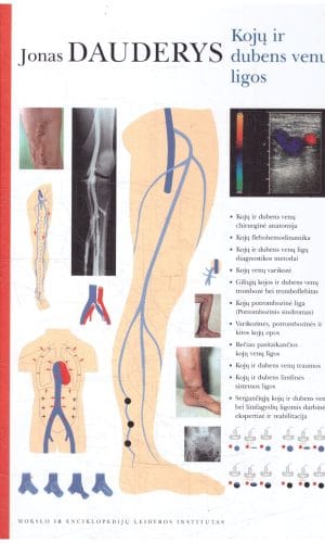 Kojų ir dubens venų ligos - Jonas Dauderys