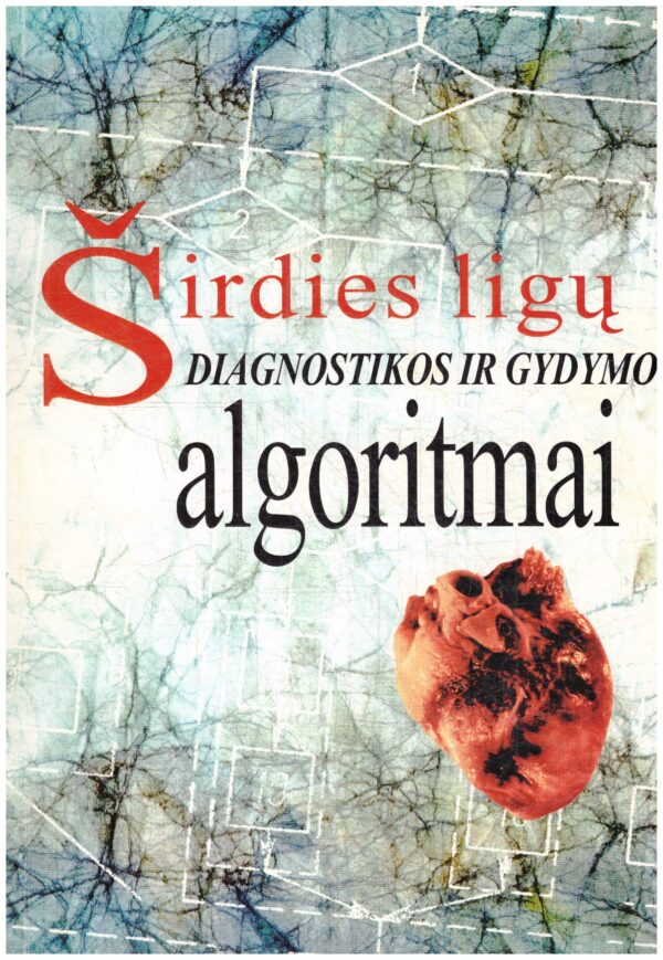 Širdies ligų diagnostikos ir gydymo algoritmai - Petras Zabiela